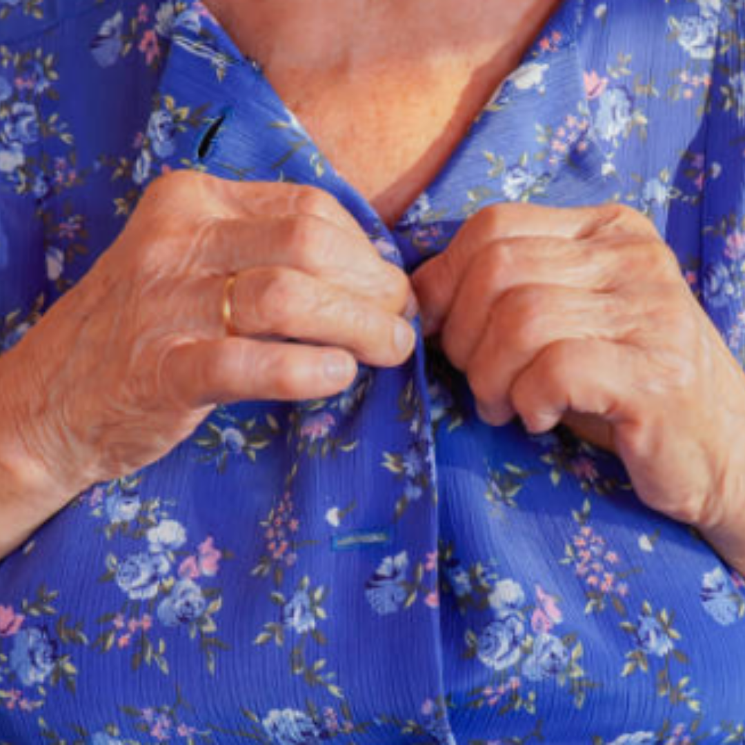 En la imagen se observa el torso de una mujer mayor que trata de abotonarse una camisa, esto hace referencia a uno de los síntomas de apraxia, la incapacidad de ejecutar un movimiento ya aprendido