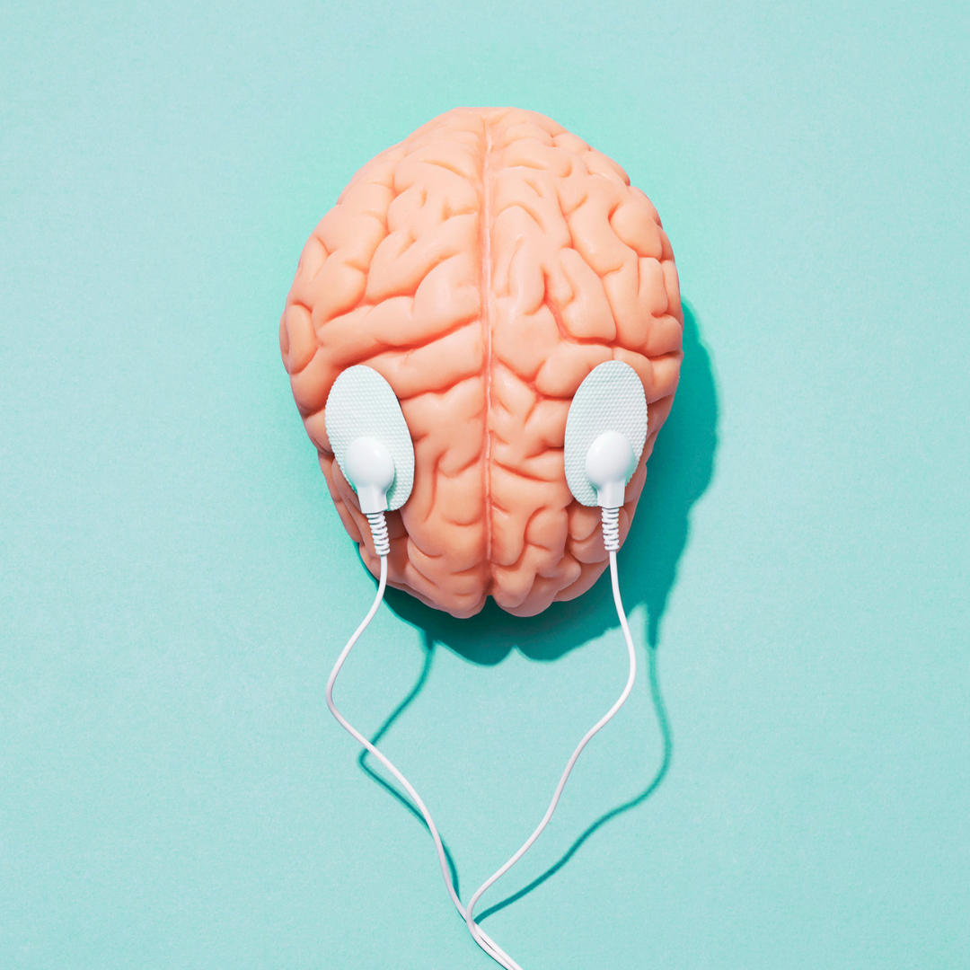 imagen de un cerebro con 2 cables conectados, haciendo referencia a los estímulos eléctricos que se envían en la estimulación cerebral profunda (ECP)