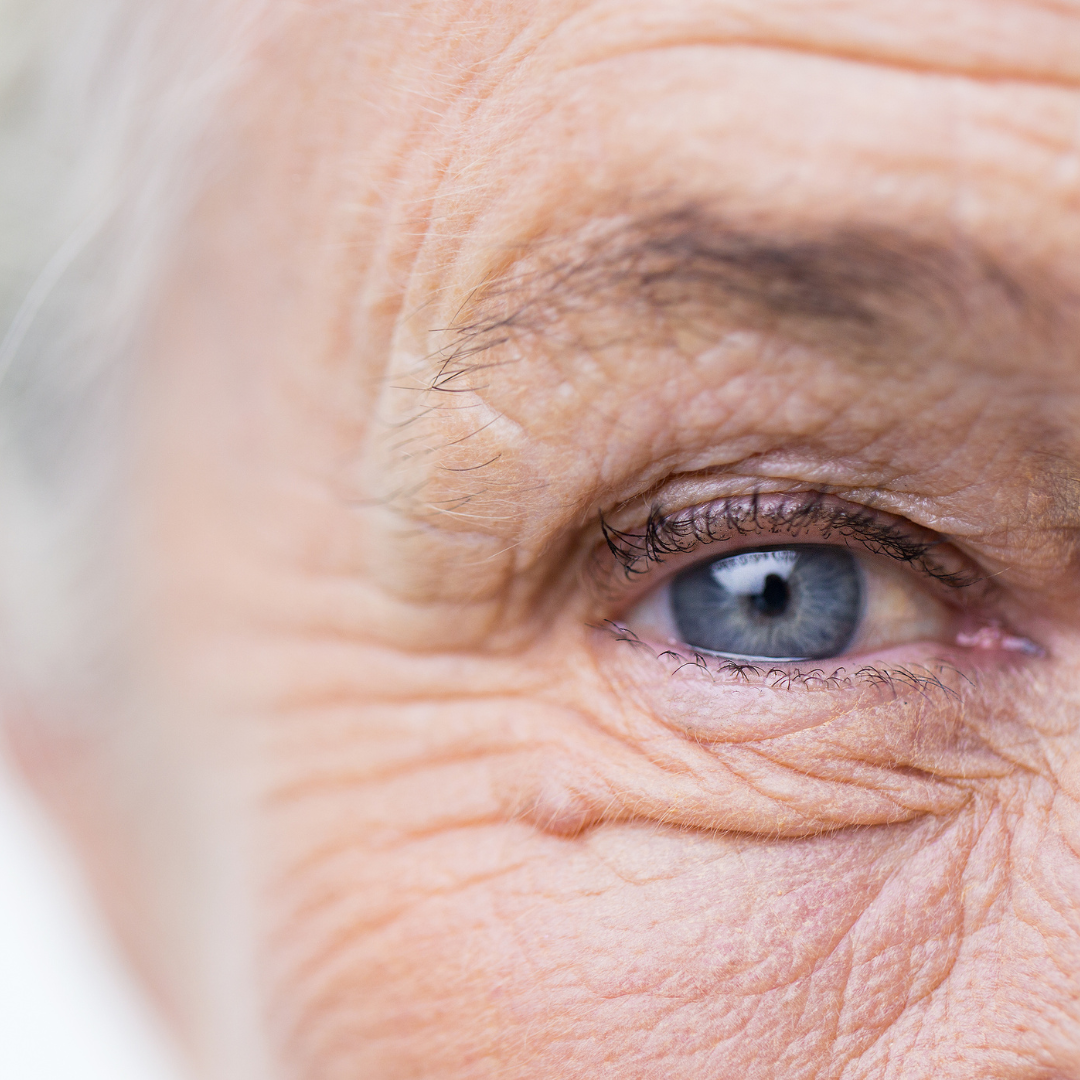 imagen del ojo de una mujer mayor, en esta, se puede apreciar su cabello y las líneas de expresión